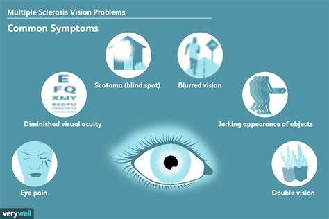 what are visual quality issues in vision